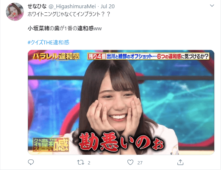 小坂菜緒の歯が変 違和感ある白さはセラミック ファン困惑 比較画像 Trend Web